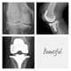 Slider image (10) Dr. Rodrigo Aguirre Rojas Orthopedic Surgeon in Mexico